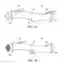 Fig. 02 - Barbed sutures