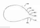 Fig. 01 - Method for approximating wounds