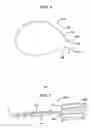Fig. 02 - Method for approximating wounds