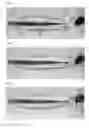 Fig. 03 - Method for approximating wounds