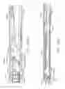 Fig. 150 - Surgical stapler with stationary staple drivers