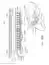 Fig. 209 - Surgical stapler with stationary staple drivers