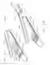 Fig. 219 - Surgical stapler with stationary staple drivers