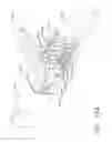 Fig. 35 - Surgical stapler with stationary staple drivers