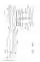 Fig. 87 - Surgical stapler with stationary staple drivers