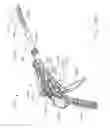 Fig. 94 - Surgical stapler with stationary staple drivers