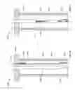 Fig. 08 - Tissue ligation devices and controls therefor