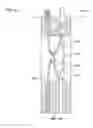 Fig. 11 - Tissue ligation devices and controls therefor