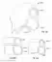 Fig. 16 - Tissue ligation devices and controls therefor