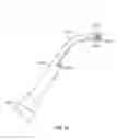Fig. 17 - Tissue ligation devices and controls therefor