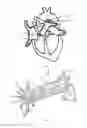 Fig. 02 - Devices and methods for treating patent ductus arteriosus