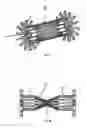 Fig. 03 - Devices and methods for treating patent ductus arteriosus