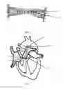 Fig. 06 - Devices and methods for treating patent ductus arteriosus