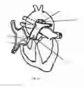 Fig. 08 - Devices and methods for treating patent ductus arteriosus