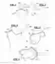 Fig. 02 - Methods and devices for installing standard and reverse shoulder implants