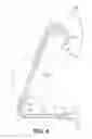 Fig. 04 - MEDICAL DEVICE FOR REMOVING PARTICLES