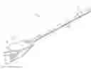 Fig. 01 - Quadriceps tendon stripper