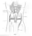 Fig. 08 - Quadriceps tendon stripper