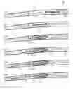 Fig. 01 - Method and apparatus for centering a microcatheter within a vasculature