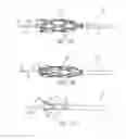 Fig. 19 - Method and apparatus for centering a microcatheter within a vasculature