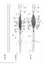Fig. 04 - Medical device and treatment method