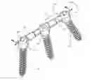 Fig. 01 - Press-On Link for Surgical Screws
