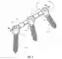 Fig. 02 - Press-On Link for Surgical Screws