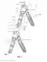 Fig. 09 - Press-On Link for Surgical Screws