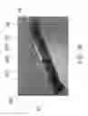 Fig. 32 - Flexible spine stabilization system