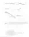 Fig. 07 - ORTHOPEDIC PLATE FOR USE IN SMALL BONE REPAIR