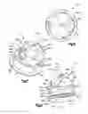 Fig. 04 - Blunt Tip Bone Screw