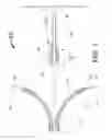 Fig. 02 - Transvascular methods of treating extravascular tissue