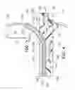 Fig. 05 - Transvascular methods of treating extravascular tissue