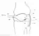 Fig. 01 - THERMALLY TREATING TORN TISSUE