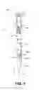 Fig. 02 - METHODS AND DEVICES FOR CREATING AN OPENING THROUGH AN ANATOMIC WALL