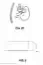 Fig. 04 - METHODS AND DEVICES FOR CREATING AN OPENING THROUGH AN ANATOMIC WALL
