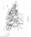 Fig. 11 - Electrosurgical instrument with sensor