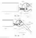 Fig. 16 - MEDICAL DEVICES, APPARATUSES, SYSTEMS AND METHODS