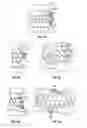 Fig. 03 - Method and apparatus for treating orthodontitis