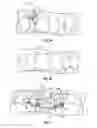 Fig. 04 - Method and apparatus for treating orthodontitis