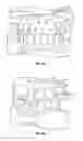 Fig. 06 - Method and apparatus for treating orthodontitis