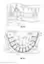 Fig. 09 - Method and apparatus for treating orthodontitis