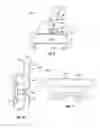 Fig. 11 - Method and apparatus for treating orthodontitis