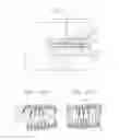 Fig. 04 - Apparatus for generating dental data for manufacturing an aligner and method of manufacturing clear aligner using the apparatus