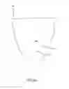 Fig. 09 - System and method for positioning three-dimensional brackets on teeth