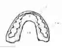Fig. 02 - Orthodontic retainer
