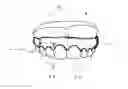 Fig. 05 - Orthodontic retainer
