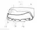 Fig. 06 - Orthodontic retainer