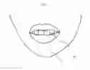 Fig. 07 - Orthodontic retainer