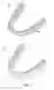 Fig. 02 - Patterned dental positioning appliance